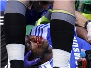 Bóng đá anh, ngoại hạng anh, lịch thi đấu euro 2012, Andre Villas - Boas tiết lộ về chấn thương của Drogba